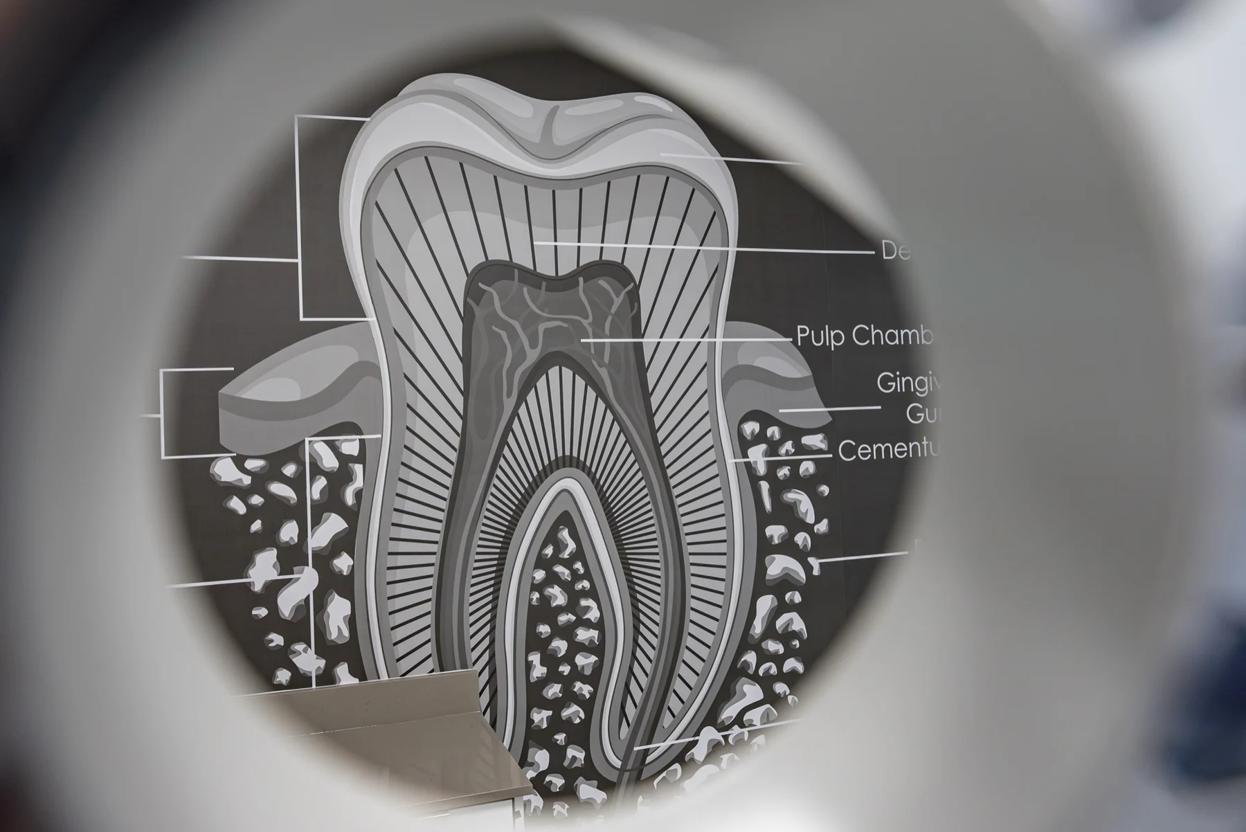 Anillo Dentistry — La gráfica del diente vista a través de una lupa dental