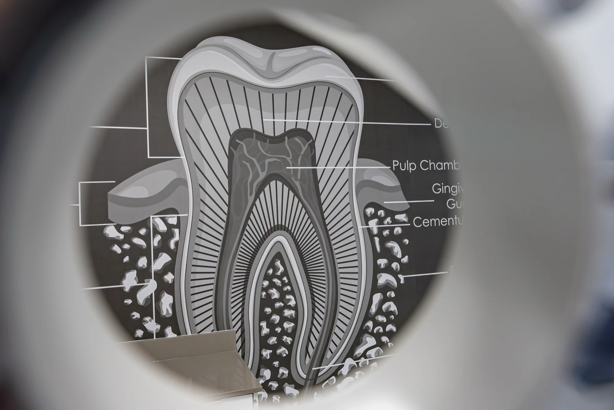 Anillo Dentistry — La gráfica del diente vista a través de una lupa dental